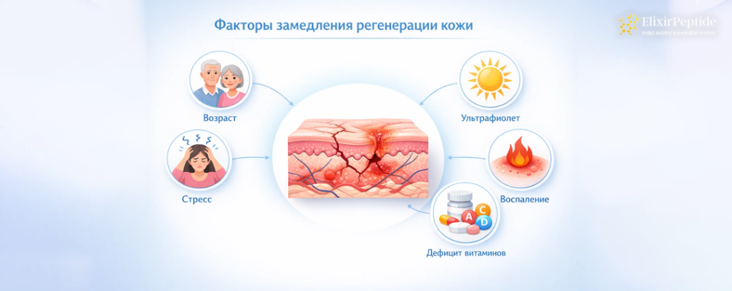 Факторы замедления регенерации кожи.png